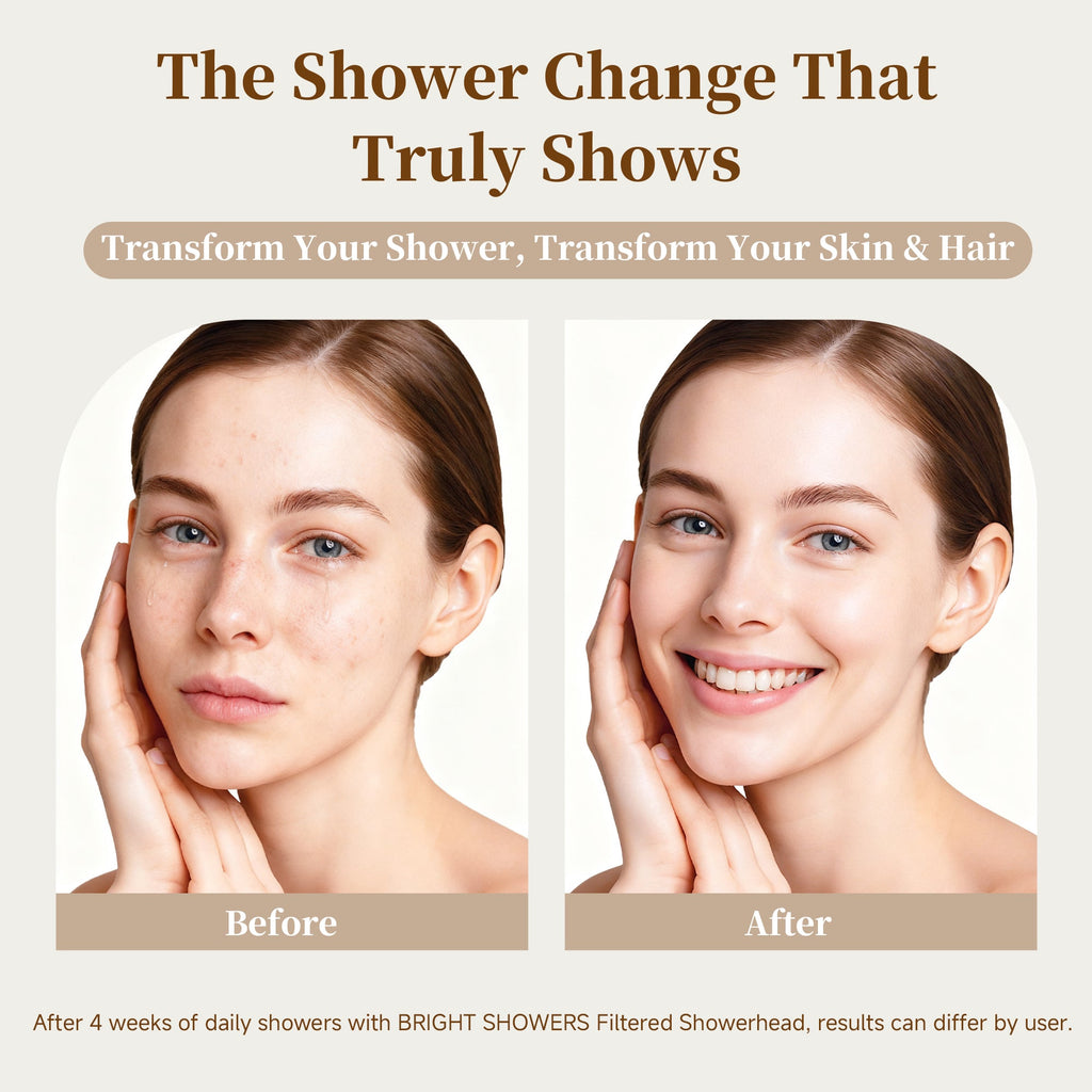 BRIGHT SHOWERS Filtered Shower Head, High Pressure Fixed Showerhead for Hard Water, Dual-Media Filter Removes Chlorine & Impurities, 8 Spray Modes